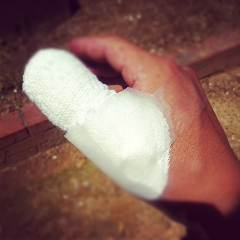 オペがオペされてもーて…